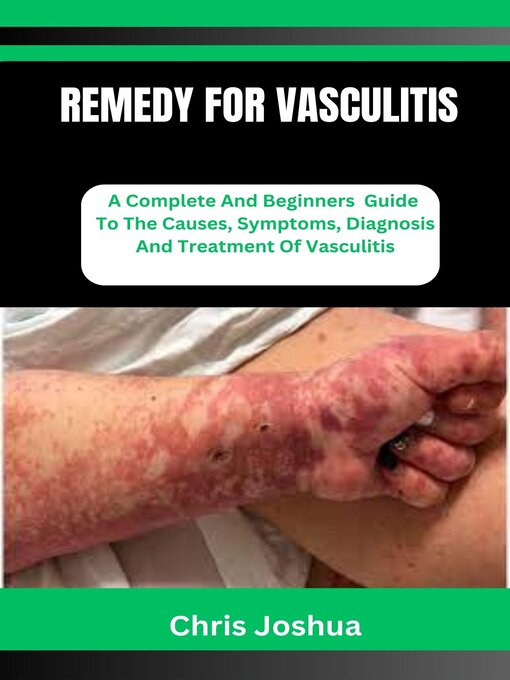 Title details for REMEDY FOR VASCULITIS by Chris Joshua - Available